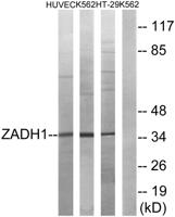 PTGR2 Polyclonal Antibody