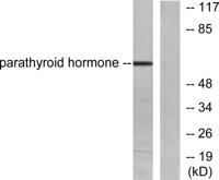 PTH Polyclonal Antibody