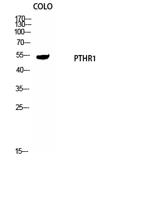 PTH/PTHrP-R Polyclonal Antibody