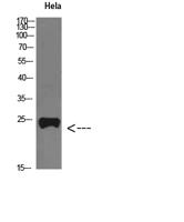 PTH-rP Polyclonal Antibody