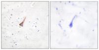 PTP1B Polyclonal Antibody