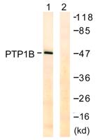 PTP1B Polyclonal Antibody