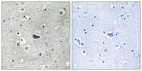 PKC δ Polyclonal Antibody