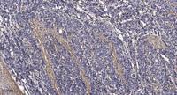 PTP22 Polyclonal Antibody