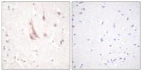 PKC ζ Polyclonal Antibody