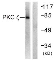 PKC ζ Polyclonal Antibody