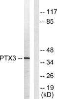 Ptx3 Polyclonal Antibody