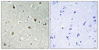 PU.1 Polyclonal Antibody