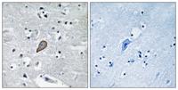 PKC θ Polyclonal Antibody