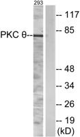 PKC θ Polyclonal Antibody