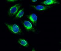 PKD1 Polyclonal Antibody