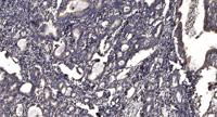 PKD1/2/3 Polyclonal Antibody