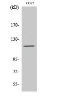 PYK2 Polyclonal Antibody