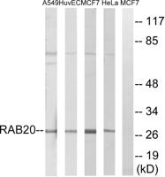 Rab 20 Polyclonal Antibody