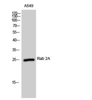 Rab 2A Polyclonal Antibody