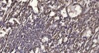 Rab 2B Polyclonal Antibody