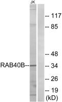 Rab 40B Polyclonal Antibody