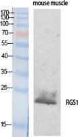 RGS1 Polyclonal Antibody