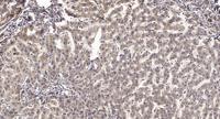 RGS12 Polyclonal Antibody