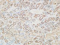 RGS16 Polyclonal Antibody