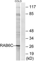 Rab 6C Polyclonal Antibody