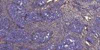 Rab 7L1 Polyclonal Antibody