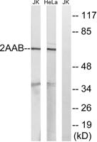 PP2A-Aβ Polyclonal Antibody