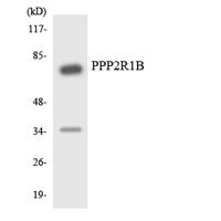 PP2A-Aβ Polyclonal Antibody