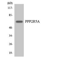 PP2A-B56-α Polyclonal Antibody