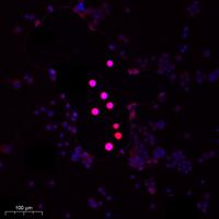 PP2A-B56-δ Polyclonal Antibody