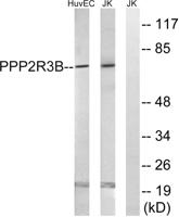 PP2A-B56-δ Polyclonal Antibody