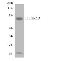 PP2A-B56-δ Polyclonal Antibody