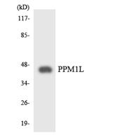 PP2Cε Polyclonal Antibody