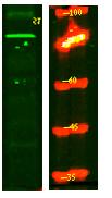 PPM1E Polyclonal Antibody