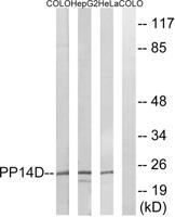 PPP1R14D Polyclonal Antibody