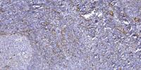 PPP1R14D Polyclonal Antibody