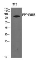 PPP1R15B Polyclonal Antibody