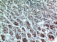 PPP1R15B Polyclonal Antibody