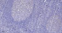 PR48 Polyclonal Antibody