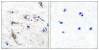 PRAF2 Polyclonal Antibody