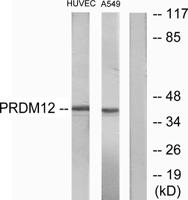 PRDM12 Polyclonal Antibody