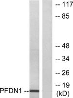 Prefoldin 1 Polyclonal Antibody