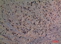 PREP Polyclonal Antibody