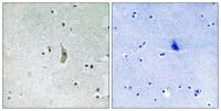 Presenilin 1 Polyclonal Antibody