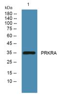 PRKRA Polyclonal Antibody