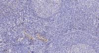 Probetacellulin Polyclonal Antibody