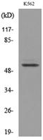 Protein C Polyclonal Antibody