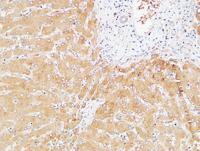 Prothrombin Polyclonal Antibody