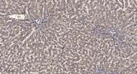 PRPF18 Polyclonal Antibody