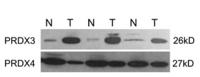 PRX III Polyclonal Antibody